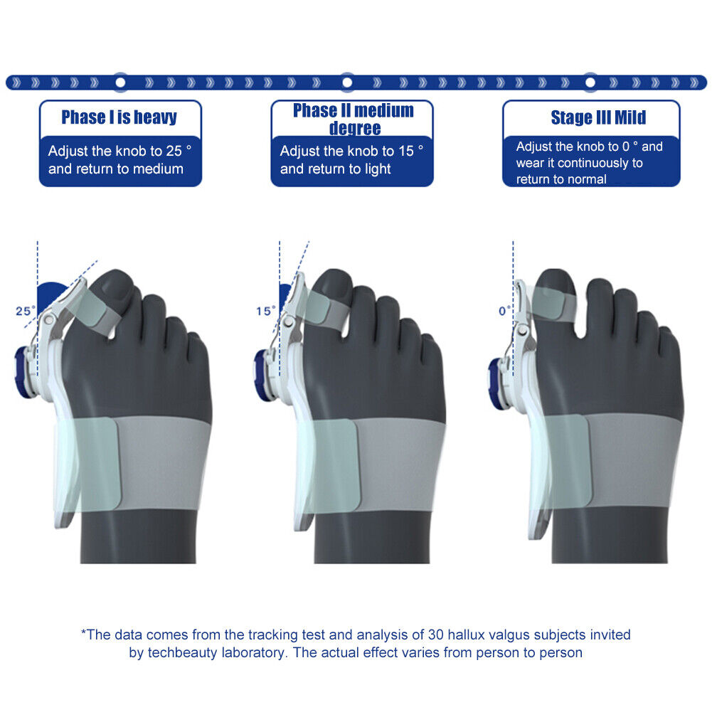 Toe Straightener Bunion Corrector